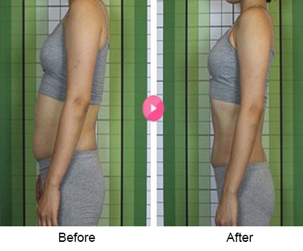 BeforeAfter_bodyslim06n