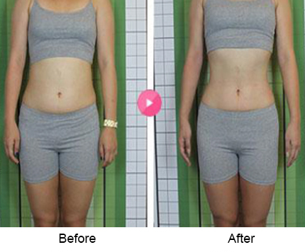 BeforeAfter_bodyslim07n