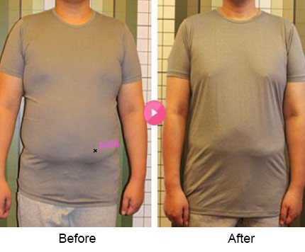 BeforeAfter_bodyslim08n