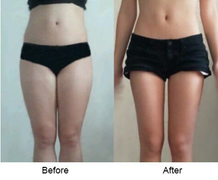 BeforeAfter_bodyslim09n