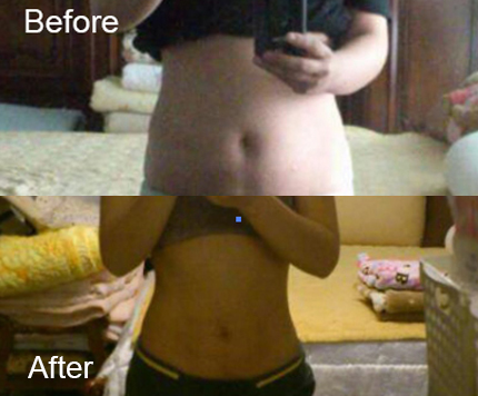 BeforeAfter_bodyslim10n