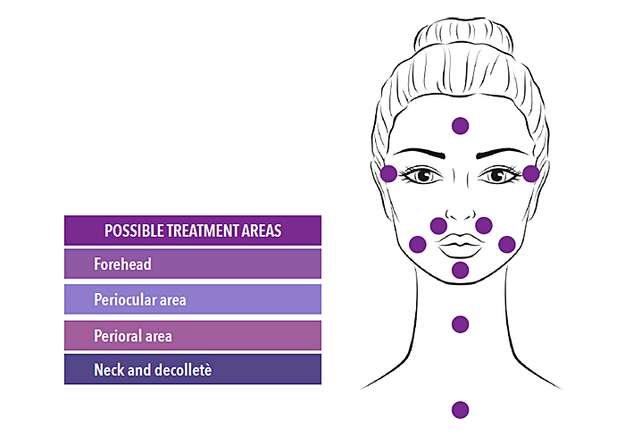 BIOR5 BIOREVITALIZING PEELING – Inderma