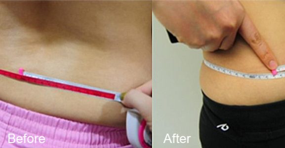 BeforeAfter_bodyslim01n