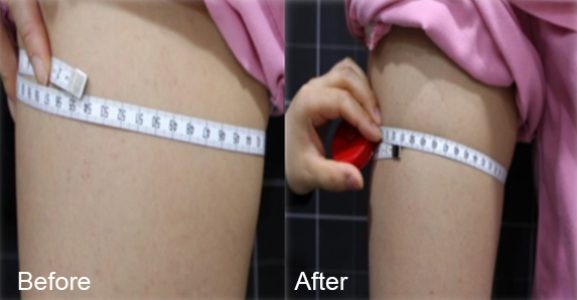 BeforeAfter_bodyslim03